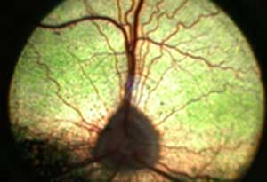 normal canine retina