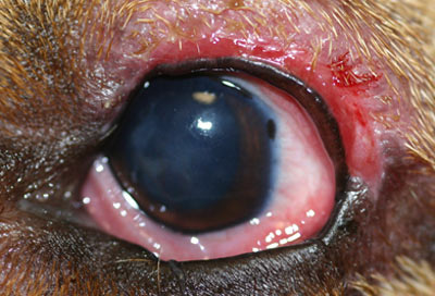Blepharitis condition signs