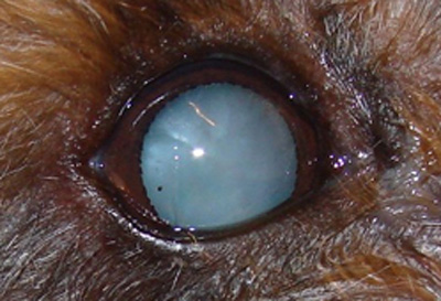 cataracts eye condition