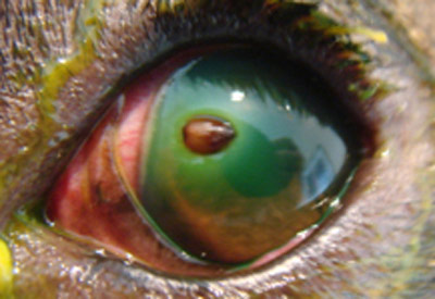 corneal foreign body